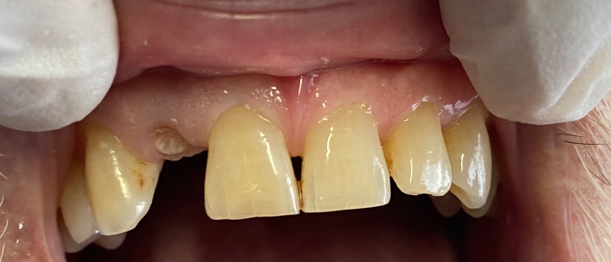 Antes - Odontología Heroica II
