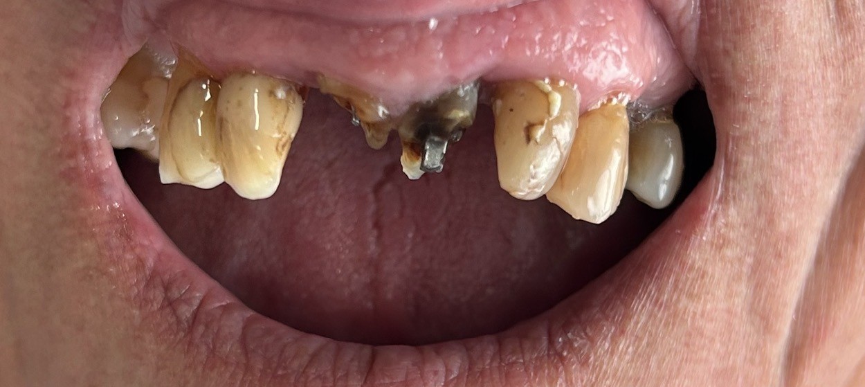 Antes - Odontología Heroica