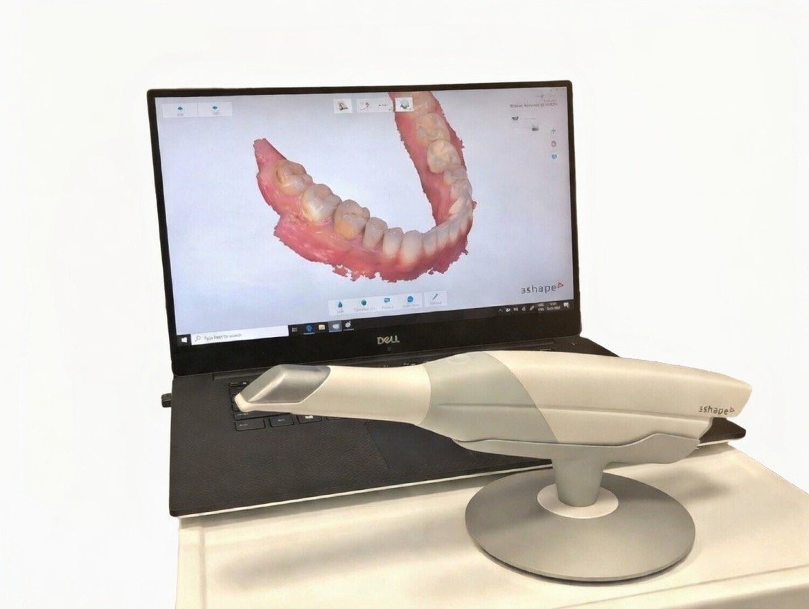 Escáner intraoral 3Shape